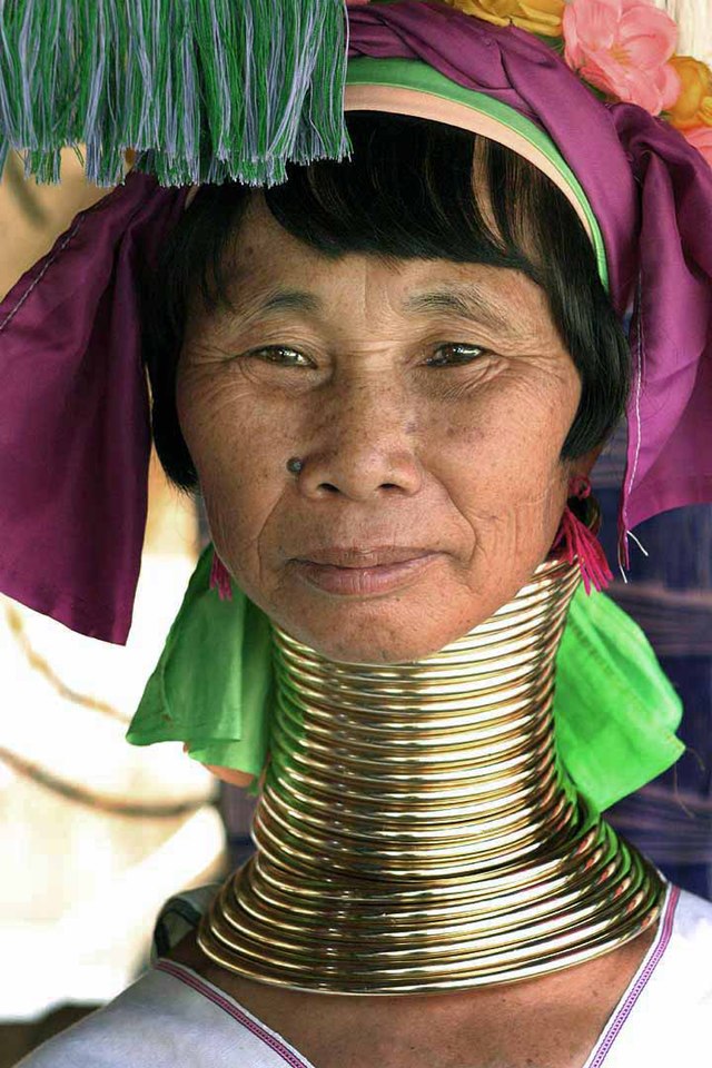 Neck Rings Removal The 11 most extreme body transformation practices in history ...